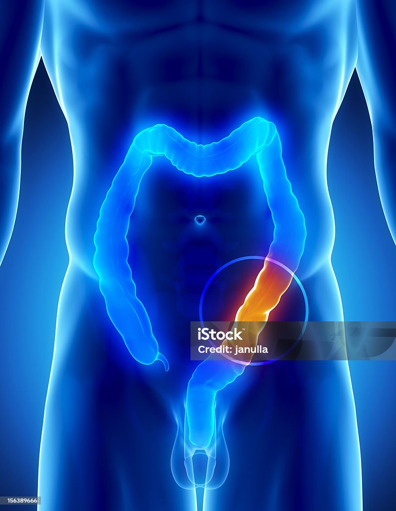 Male COLON problem - digestive system Male anatomy of human organs in x-ray view Abdomen Stock Photo