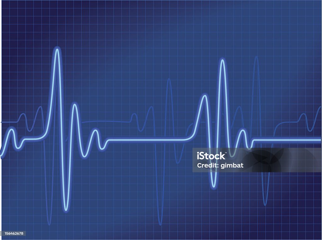 Representation of a cardiogram output in blue All elements are separate objects and grouped. File is made with gradient & mesh. No transparency.  Analyzing stock vector
