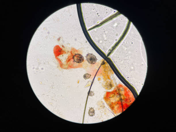 istock Notoedres cati under the microscope. Notoedric mange, also referred to as Feline scabies, is a highly contagious skin infestation caused by an ectoparasitic and skin burrowing mite Notoedres cati. 1565074607