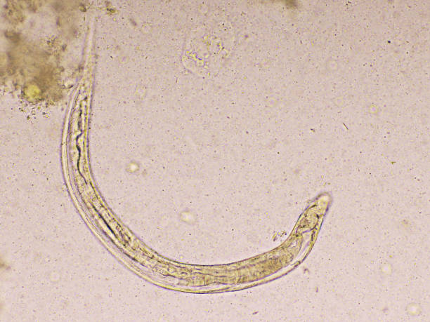 strongyloides stercoralis or threadworm in human stool - worm poop imagens e fotografias de stock