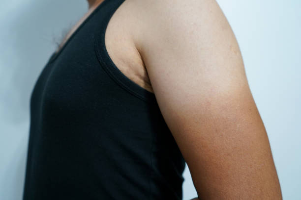 istock Brown tan lines on man's arm, sunburn 1565256442