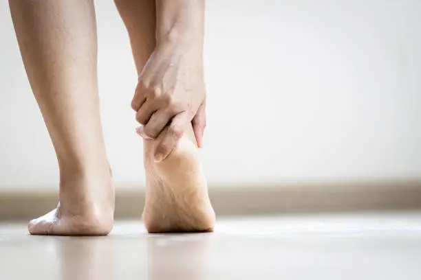 Asian woman holding heel with her hand,symptom of Plantar Fasciitis,problem of achilles tendon suffer from achilles tendinitis,pain and stiffness in muscle and ligaments of leg,feet hurt while walking