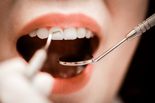 Dental health care and Dentist equipment concept. Dentist examining teeth patients in clinic for better dental health and a bright smile. Dentist checking teeth with tools.