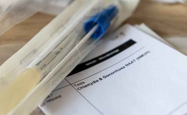 a sample container and medical form for a chlamydia and gonorrhoea test. - sti imagens e fotografias de stock