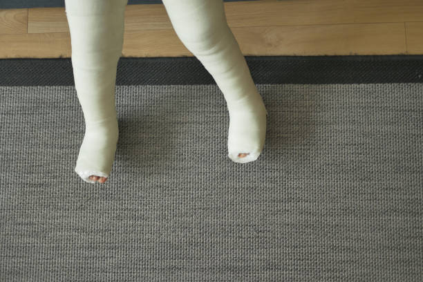 istock little child with plaster bandage on leg. 1567421993