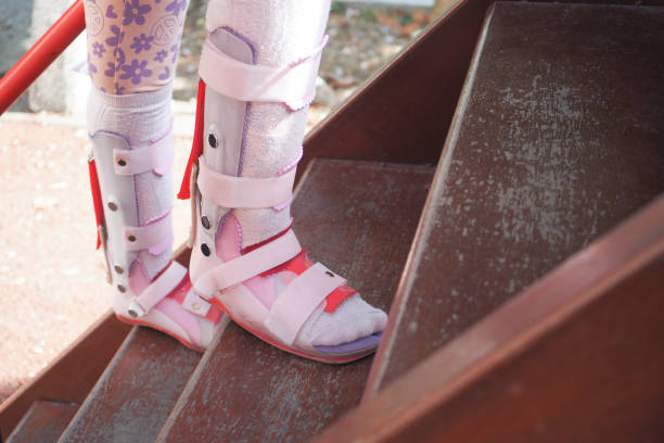 istock Child cerebral palsy disability, legs orthosis. 1567443386