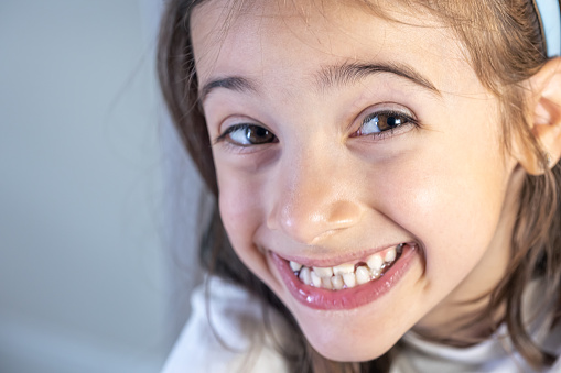 Little happy kid girl at dentist office smiling showing overbite teeth, child during orthodontist visit and oral cavity check-up, children tooth care and hygiene.