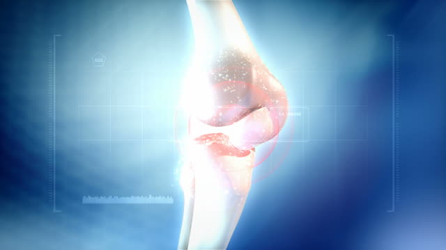 HD: Knee pain animation