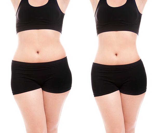 Woman's body before and after a diet stock photo