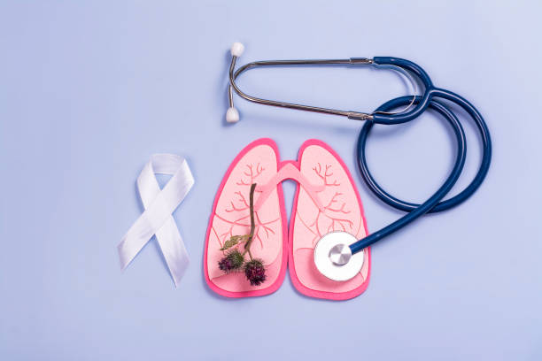 Lung cancer day. World pneumonia, tuberculosis awareness day stock photo
