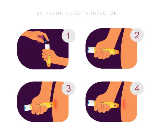 Vector illustration of Adrenaline- hormone Injection for Severe Food Allergy - Stock Illustration