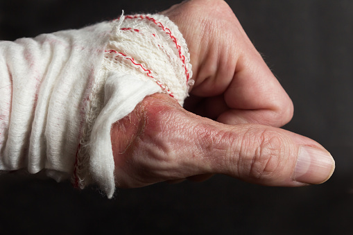 Close-up, female hands sewing on fabric with zipper using needle and thread. Scissors are on the right. The woman has pins in her arm. Fashion designer.