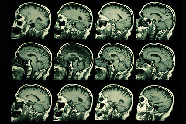 w badaniu mri mózgu - mri scan cat scan machine x ray brain zdjęcia i obrazy z banku zdjęć