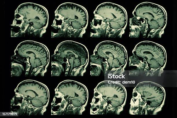 Cérebro Com Rmn - Fotografias de stock e mais imagens de Cérebro - Cérebro, Máquina de Ressonância Magnética, Exame de Ressonância Magnética