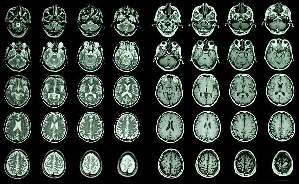 w badaniu mri mózgu - mri scan cat scan machine x ray brain zdjęcia i obrazy z banku zdjęć