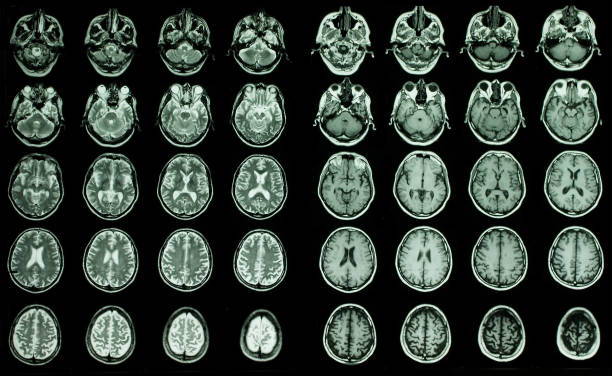 в мрт головного мозга - brain mri scanner mri scan medical scan стоковые фото и изображения