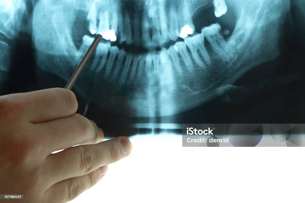 Dental X-Ray - Lizenzfrei Berufliche Beschäftigung Stock-Foto