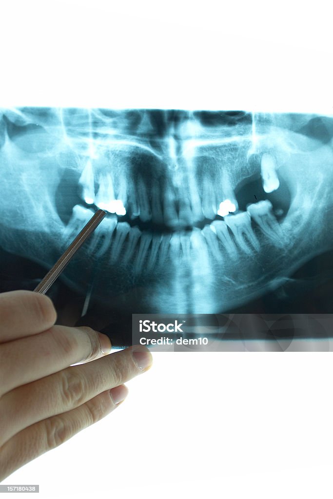 Dental X-Ray - Foto de stock de Concentração royalty-free