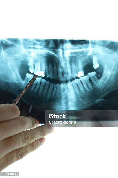 Foto de Dental Xray e mais fotos de stock de Concentração - Concentração, Consultório Dentário, Contemplação