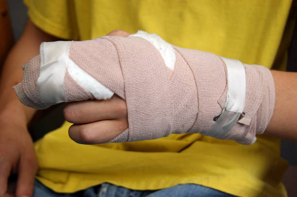 Injured person shows off wrist cast Teenager with hand injury bandage stock pictures, royalty-free photos & images