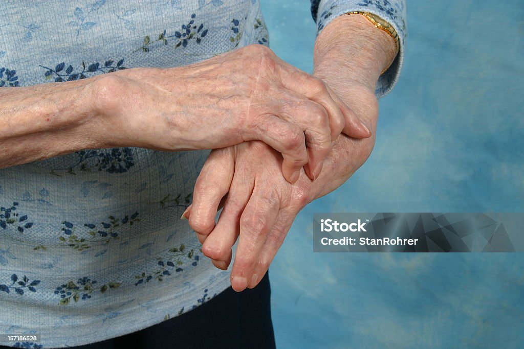 Arthritic mãos artrite reumatismo - Foto de stock de Artrite royalty-free