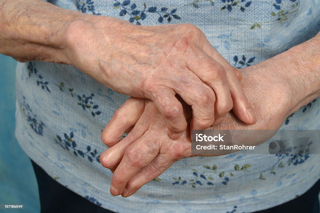 Hands-フロント、関節炎と同時に関節リウマチ - 関節炎のロイヤリティフリーストックフォト