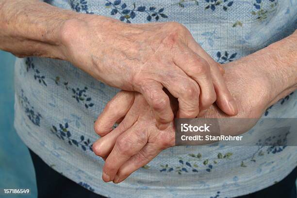 Handsフロント関節炎と同時に関節リウマチ - 関節炎のストックフォトや画像を多数ご用意 - 関節炎, 変形性関節症, リウマチ