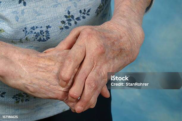 Arthritische Hände Arthritis Rheumatismus Stockfoto und mehr Bilder von Rheumatismus - Rheumatismus, Arthritis, Alter Erwachsener