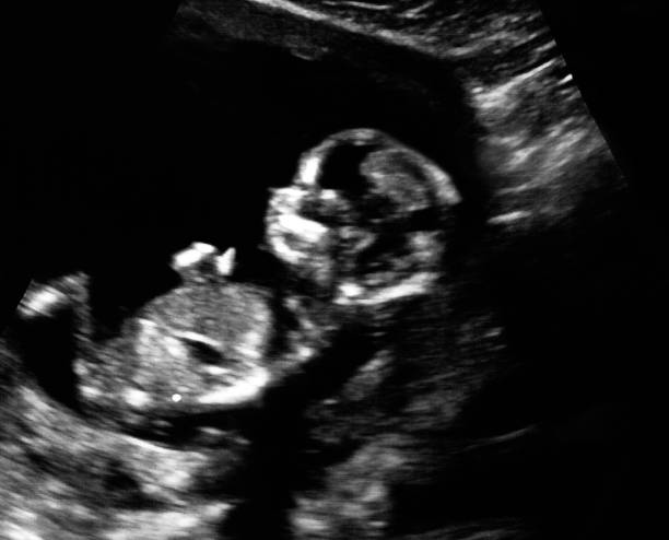100 Funny Ultrasounds Stock Photos, Pictures & Royalty-Free Images - iStock 100 Funny Ultrasounds Stock Photos, Pictures & Royalty-Free Images - iStock