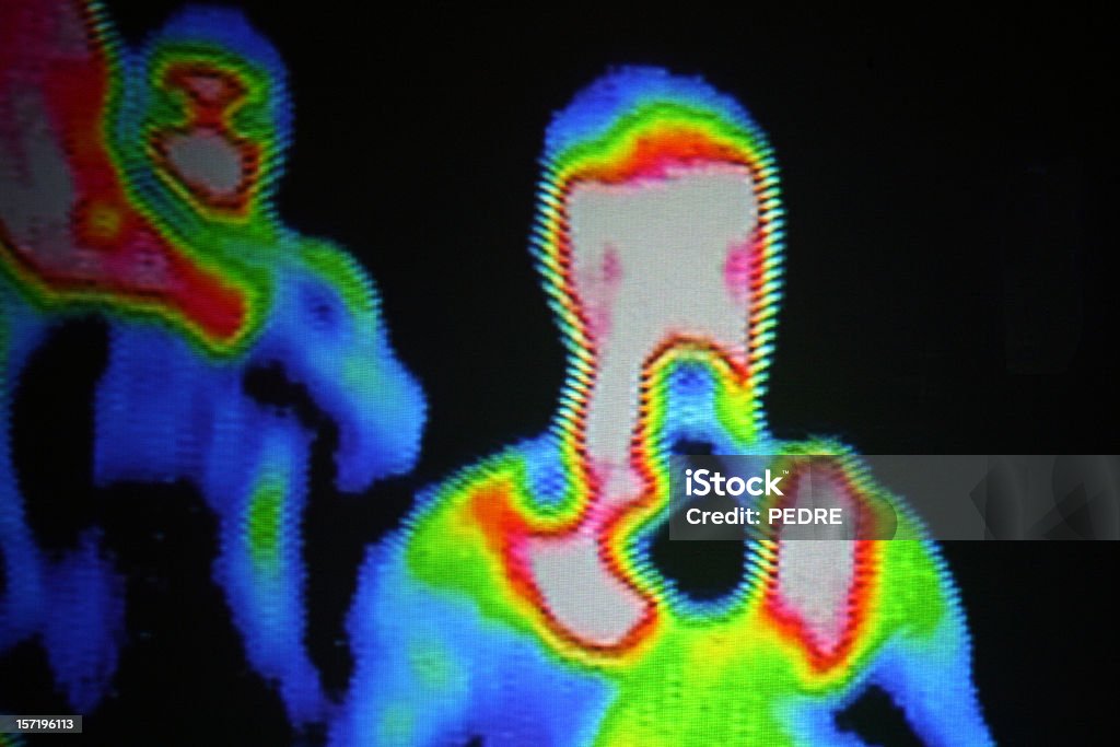 Thermographic areas of a photographer  Thermal Image Stock Photo