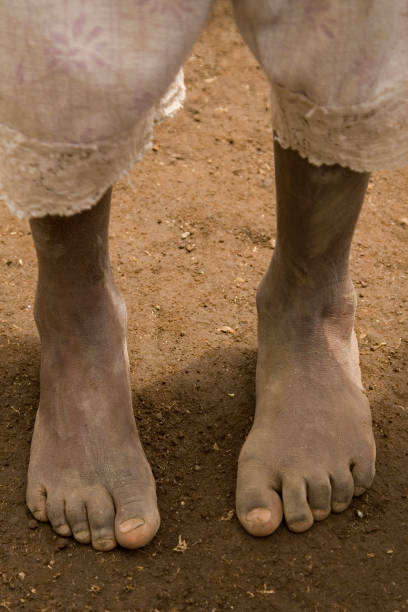 istock African girl on bare feet 157197414