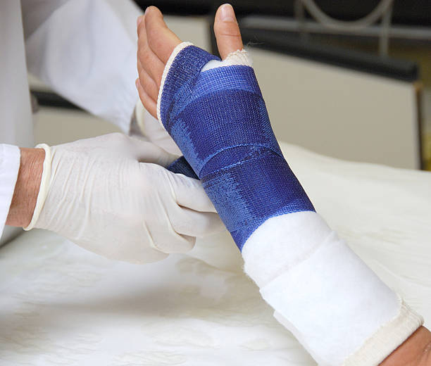 Broken arm  orthopedic cast stock pictures, royalty-free photos & images