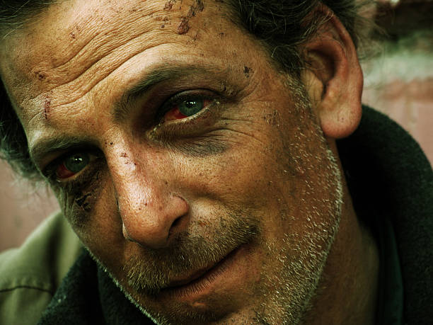 istock Old Beaten Up Homeless Man 157281110
