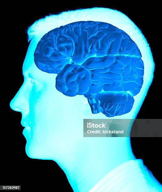 Gehirnscan Stockfoto und mehr Bilder von Röntgenbild - Röntgenbild, Alzheimer-Krankheit, Heilbehandlung