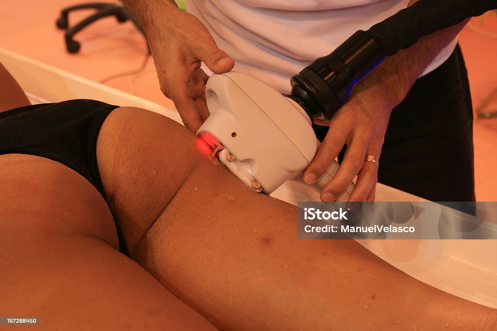 Laser Hair Removal depilation Alternative Therapy Stock Photo