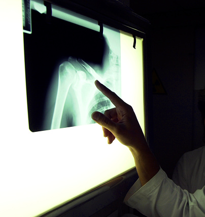Examinating an x-ray at hospital