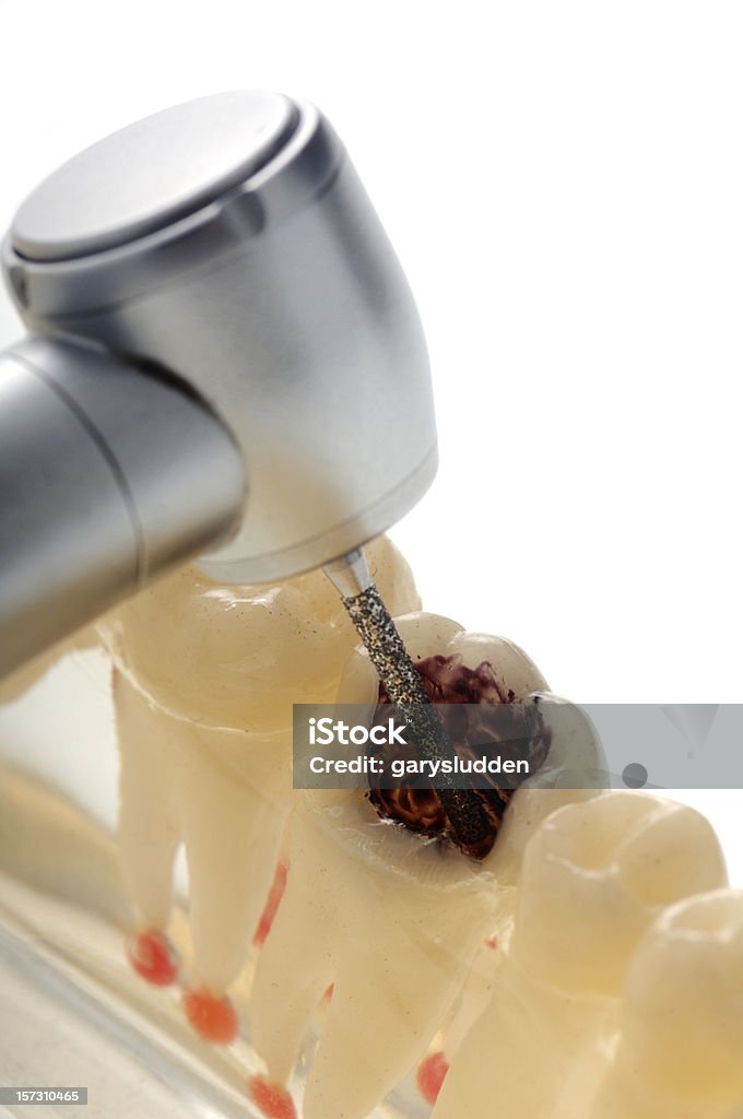 drilling einen Zahn - Lizenzfrei Farbbild Stock-Foto