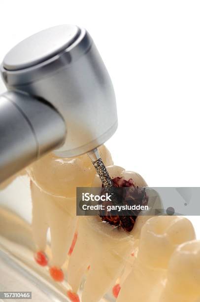 Foto de Perfuração Um Dente e mais fotos de stock de Broca dentária - Broca dentária, Cárie dentária, Dente Humano