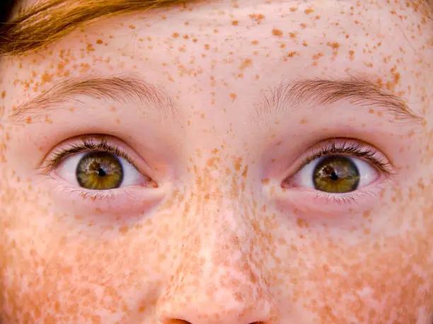 Photo of Child & Eyes Wide Open, Irish Redhead Freckle Face Surprised Girl