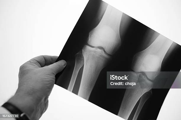 Doctor Examining Xray Image Of Human Knee Xxl Stock Photo - Download Image Now - X-ray Image, Healthcare And Medicine, Joint - Body Part