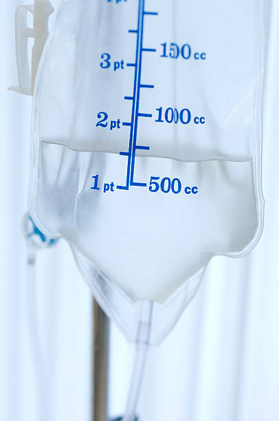perfusion intraveineuse - iv drip chemotherapy drug bag intensive care unit photos et images de collection