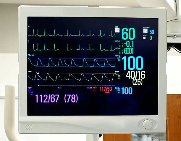 Photo of Monitor with Vital Signs: EKG, Pulse Oximetry, Blood Pressure