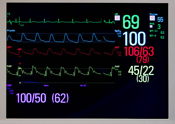 Cardiac monitor displays EKG, pulse, and blood pressure EKG, pulse oximetry, systemic blood pressure and pulmonary blood pressure displayed on patient's monitor. monitoring equipment stock pictures, royalty-free photos & images