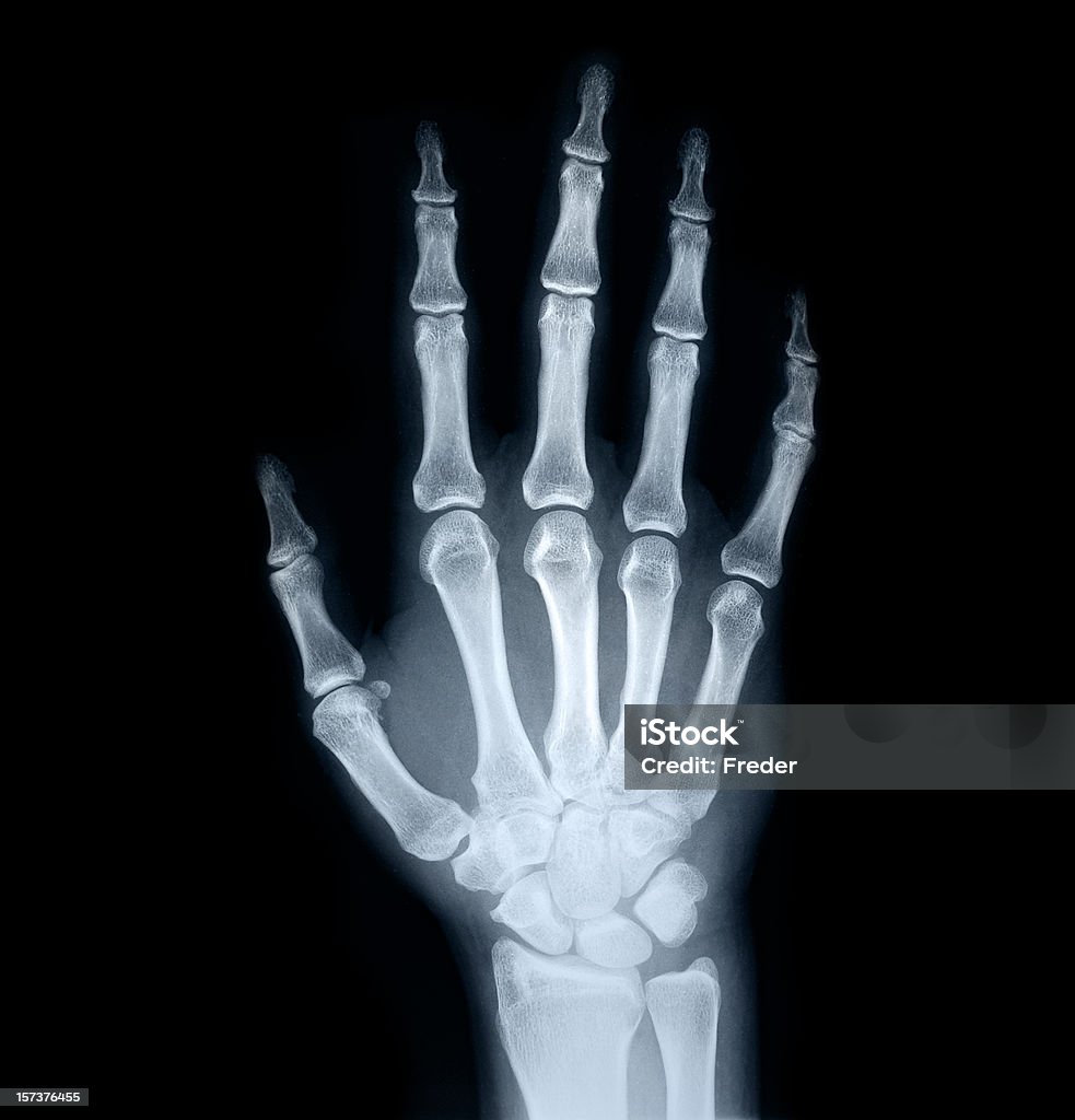 x-ray de mano humana - Foto de stock de Imagen de rayos X libre de derechos