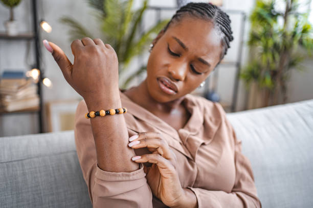 une femme noire gratte sa peau sèche qui démange sur son avant-bras - eczema photos et images de collection