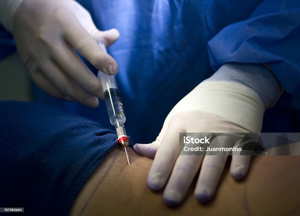 Injecter anesthesia - Photo de Anesthésique libre de droits