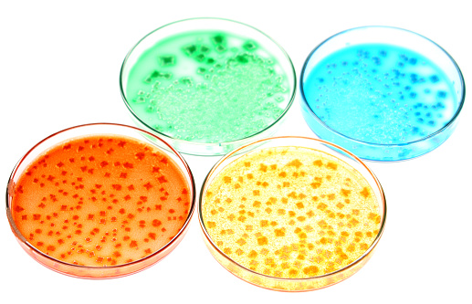 Culture in petri dishes, several colors and different growing patterns