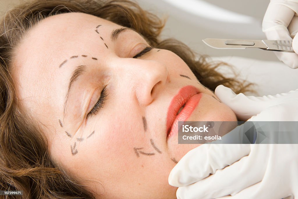 Facial cirugía plástica - Foto de stock de 40-49 años libre de derechos