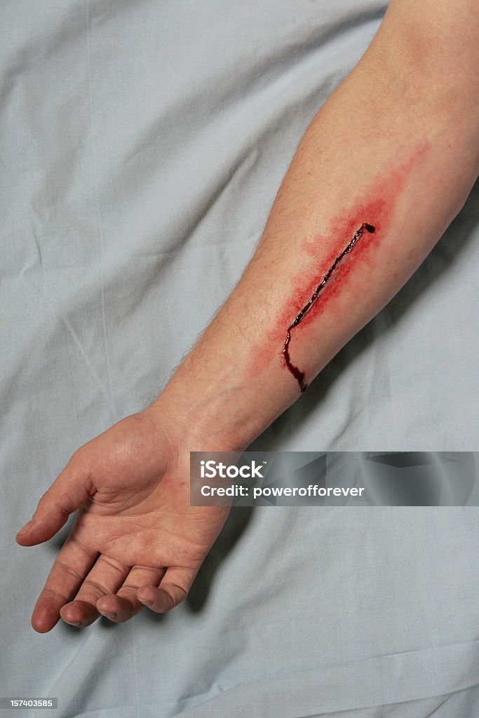 Medium Depth Incision to Forearm *THIS IS NOT REAL - SPECIAL EFFECTS MAKE UP* Medium Depth Incision to Forearm. Jagged edged cut approximately 10cm long. Blood Stock Photo