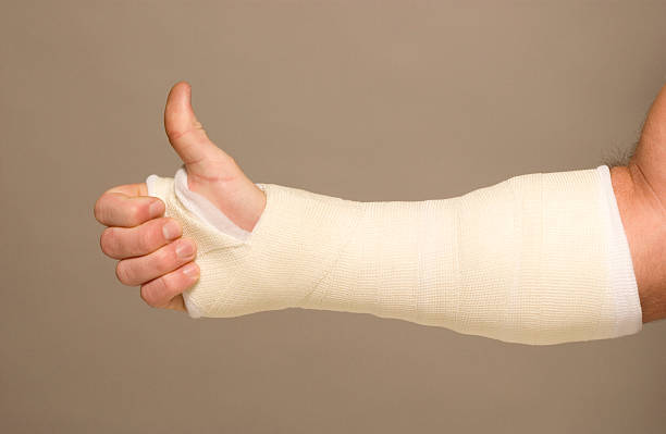 Mans arm in cast  orthopedic cast stock pictures, royalty-free photos & images